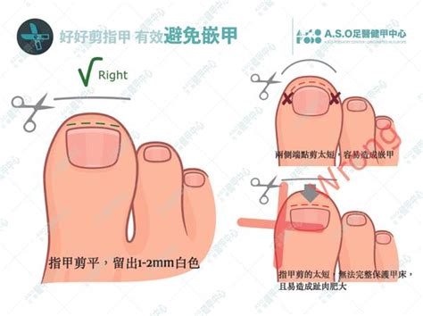 如何剪腳指甲